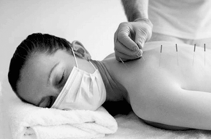 Dry needling avec un kinésithérapeute à Paris