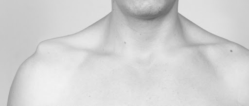 entorse acromio-claviculaire