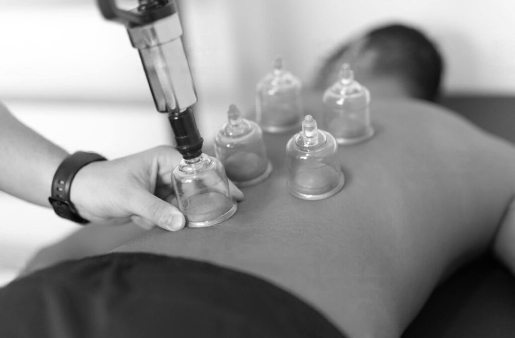 cupping thérapie ventousothérapie ventouse bienfaits kiné à paris