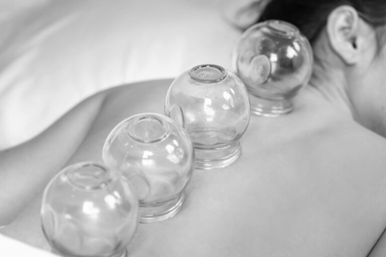 Cupping therapy à Paris. Hijama à Paris. Ventousothérapie à Paris avec un kiné ou ostéopathe