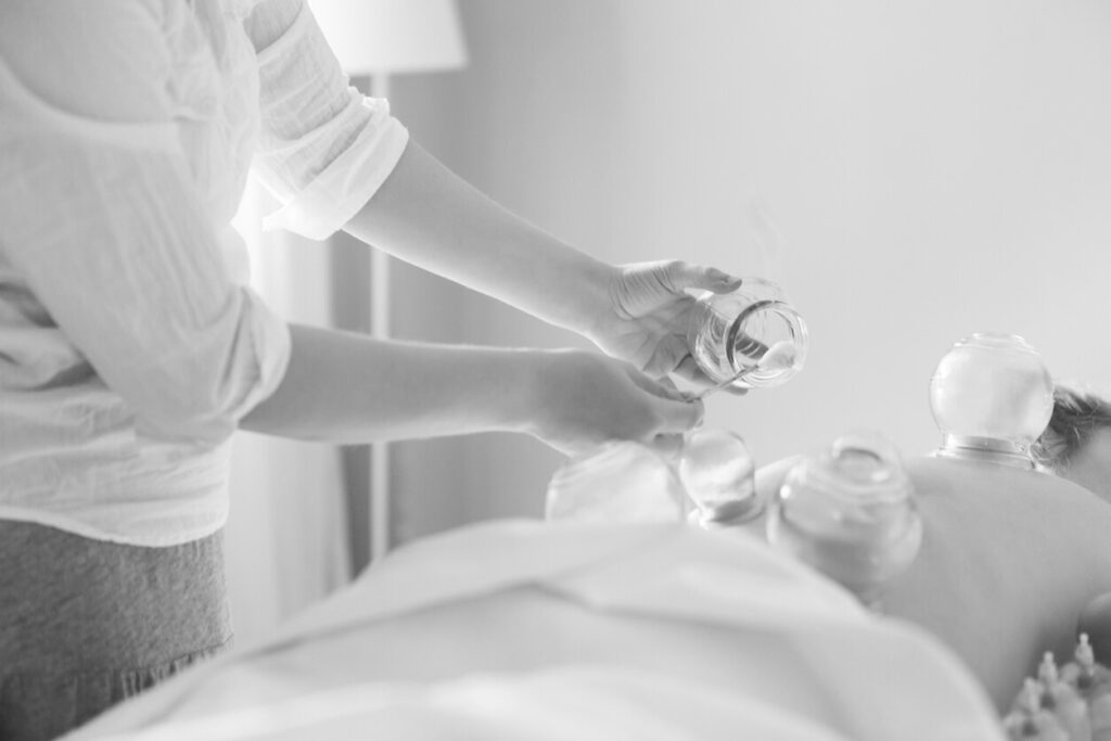Cupping therapy Paris