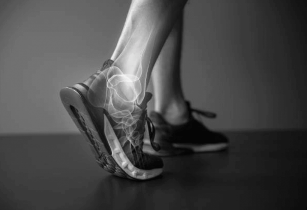 algodystrophie cheville kiné sport marche traitement symptomes durée