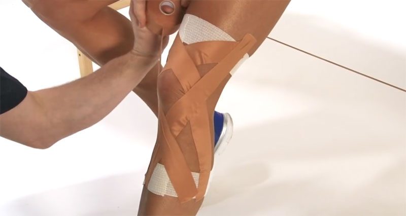 strapping du genou indications